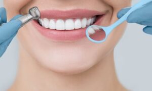 Dental Implant Marketing: Grow Your Practice, One Smile at a Time