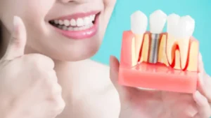 Unlocking Success: Effective Lead Generation for Dental Implants